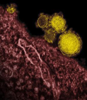 MERS-CoV Դ WHO revises MERS-CoV surveillance advice